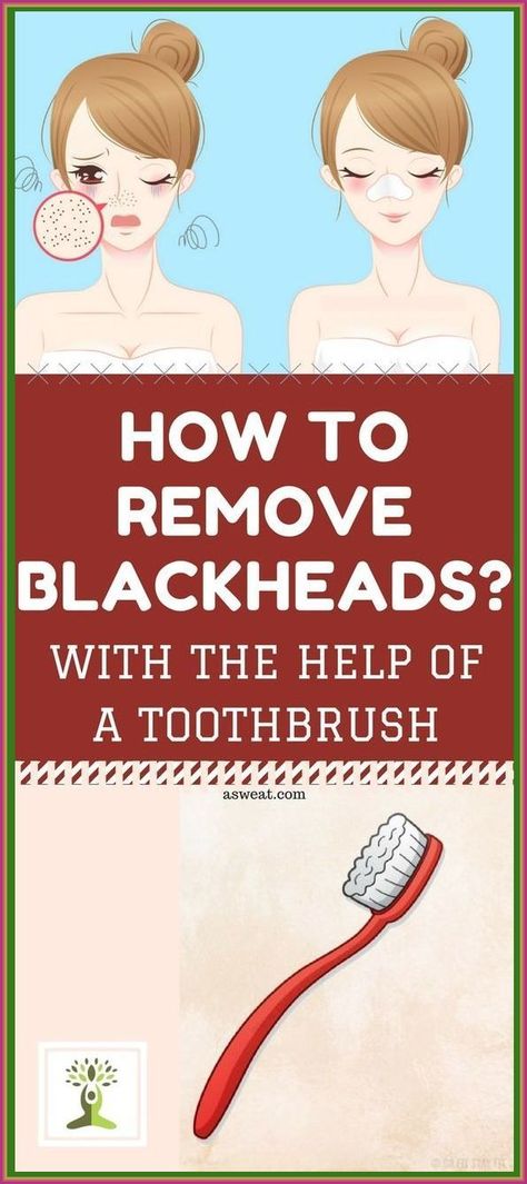 How to Remove Blackheads with the Help of a Toothbrush How To Remove Blackheads, Cleaning Your Colon, To Remove Blackheads, Health Signs, Remove Blackheads, Health Planner, Creating A Newsletter, Back Pain Exercises, Skin Condition