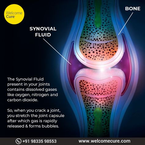 #DidYouKnow? The sound from cracking knuckles comes from a specific gas accumulated in your joints. #WelcomeCure #Natural #crackingknuckles #gasbubbles #knuckles #fact Cracking Knuckles, Synovial Fluid, Did You Know Facts, Carbon Dioxide, The Sound, Did You Know, Fun Facts, Bubbles, Sound