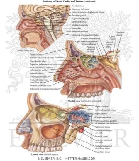 Sinus Anatomy Maxillary Sinus Anatomy, Sinus Anatomy, Maxillary Sinus, Medical Template, Medical Coding, Family Health, Anatomy, Medical, University