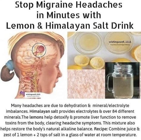 How To Stop Migraines, Healthy Happy Life, Naturopathic Medicine, Home Doctor, Healing Plants, Migraine Relief, Citrus Juice, Migraine Headaches, Healing Herbs