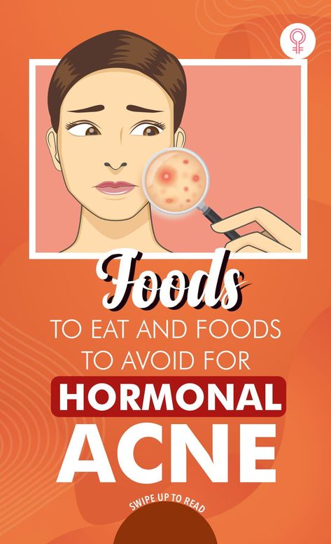 Acne Diet Plan, Hormonal Acne Diet, Food For Acne, Chin Acne, Hormonal Acne Remedies, Back Acne Remedies, Acne Diet, Natural Acne Remedies, Hormonal Acne