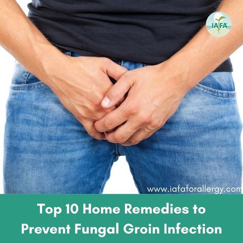 Fungal Groin Infection Groin Rash, Fungal Rash, Types Of Rashes, Yeast Infection Causes, Fungal Infection Skin, Longevity Diet, Top 10 Home Remedies, Flaking Skin, Infection Prevention