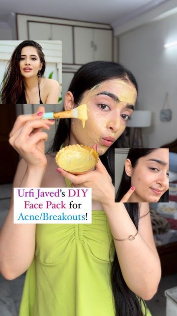 Kareena Tekwani | Beauty Influencer💜 on Instagram: "Urfi Javed’s DIY Face Mask for Acne & Breakouts while getting bright, soft, Glowing Skin 🤌🏻😱❤️

SOO i saw this video long back on Youtube and I definitely wanted to try it out so here you go guys, i tried it out when i was going through major acne & within like 3-4 days my acne completely disappeared & skin definitely felt softer, glowy and WAYY more brighter than it actually was!✅

Ingredients-
1 tbsp Curd
1 tbsp Besan
Pinch of Grated Haldi ( Raw or Whole )
Pinch of Cinnamon (Daal Cheeni)
1/2 a lemon (optional)
1/2 tbsp Honey

P.S. You can use this to treat your body acne as well, but i would suggest noticing if it’s working for your face first & then trying it on your body! Use it on alternate days for best results !✨

Let me know t Besan Face Mask Glowing Skin, Face Mask Glowing Skin, Diy Face Mask For Acne, Face Mask For Pimples, Face Mask For Acne, Urfi Javed, Mask For Acne, Body Acne, Acne Breakout