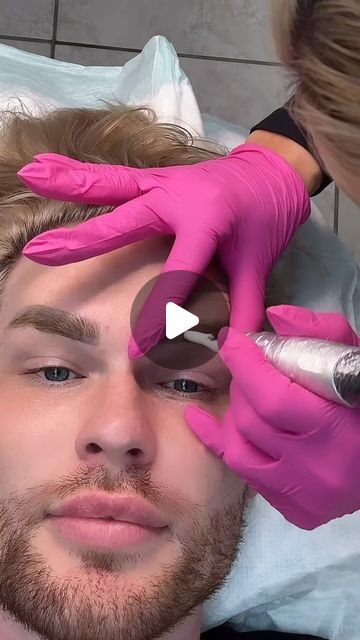 Zach Mesquit on Instagram: "Have you heard of magnetic tattoo removal?! This process was so satisfying. Stay tuned for updates 
#browtattooremoval #tattooremoval #permanentmakeup #pmu" Magnet Tattoo, Magnetic Tattoo, Brow Tattoo, So Satisfying, Tattoo Removal, Permanent Makeup, Stay Tuned, Magnets, Tattoos