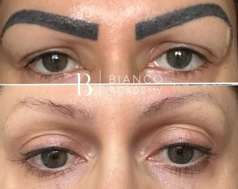 Pmu Eyebrows, Eyebrow Tattoo Removal, Eyebrows Tattoo, Tattoo Eyebrows, Remove Tattoo, Cosmetic Tattoo, Eyebrow Tattoo, Tattoo Removal, Permanent Makeup