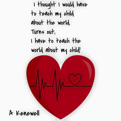 Chd Valentines, Hlhs Quotes, Chd Awareness Quotes, Chd Quotes, Organ Donor Quotes, Chd Mom, Chd Babies, Chd Warrior, Heart Mum