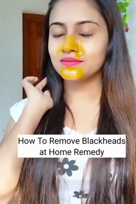 Blackheads Removing Home Remedy#Blackheads#home remedy Home Remedies For Pimples, Blackhead Remedies, To Remove Blackheads, Blackheads On Nose, Clear Skin Face, Diy Skin Care Routine, Natural Face Skin Care, Slim Diet, Remove Blackheads