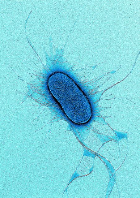 E. coli negatively stained with 1% Uranyl acetate. Microscopic image Coagulation Factors, Food Contamination, Macro Fotografie, Microscopic Organisms, Micro Photography, Medical Laboratory Science, Microscopic Images, Electron Microscope, Food Poisoning