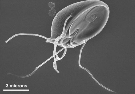 Human giardia close-up Giardia In Humans, Animal Intelligence, Intestinal Parasites, Anti Aging Supplements, Large Intestine, Aids Hiv, Disease