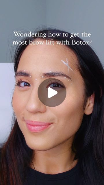 Niki Lister on Instagram: "A Botox brow lift is a thing of beauty, but it takes more than a few pricks to achieve that perfect arch.

It’s all about strategic placement and precise dosing. We’re talking millimeters and tiny adjustments to target the right muscles.
But here’s the thing: It’s not a one-size-fits-all approach. Every face is a masterpiece, and the amount of Botox needs to be tailored  to your unique anatomy and desired lift. 
Too much, and you lose that natural expressiveness. Too little, and we miss the mark.
That’s why it’s so important to seek an injector with a keen eye and a proven track record!

Ready to elevate your brows and your confidence? 
shoot me a DM and let’s chat! 

#BrowLiftArtist #BotoxExpertise #NaturalEnhancement #SubtleLift #YourBestYou #417botox #417aesth Botox Eyes, Botox Brow Lift, Brow Lift, A Thing Of Beauty, Eye Lift, The Thing, It Takes, A Thing, Muscles