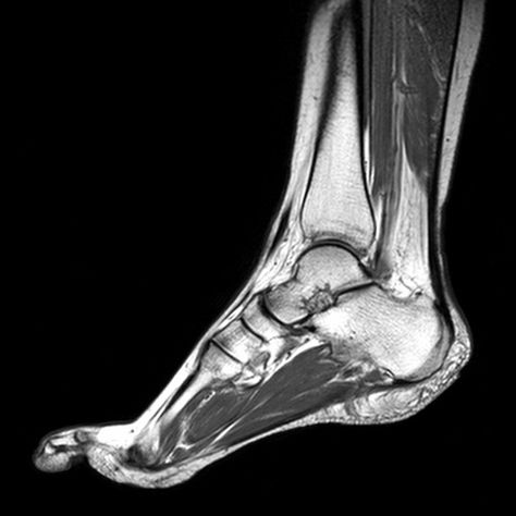 G : ' mri scan foot' Mri Scan, Foot Care, Radiology, X Ray, Long Beach, To Learn, Abstract Artwork, Not Found