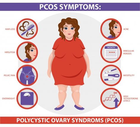 Mast Cell Activation Syndrome, Polycystic Ovarian Syndrome, Fertility Center, Polycystic Ovaries, Pelvic Pain, Pregnancy Symptoms, Hormone Health, Best Doctors, Essie