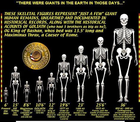 Genesis Chapter 6 tells us: “There were giants in the Earth in those days, and afterward.” The biblical Goliath was said to be only one of… Robert Wadlow, Giant Skeletons Found, Human Giant, Nephilim Giants, Giant People, Giant Skeleton, Genesis 6, 3 Brothers, Arte Alien