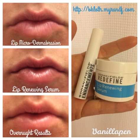 I saw overnight results with this mini regimen! Let me help you restore your lips! http://bkloth.myrandf.com Dream Bigger, Rodan And Fields, Your Lips, Dream Big, I Saw, Serum, Let Me, Lips, Let It Be