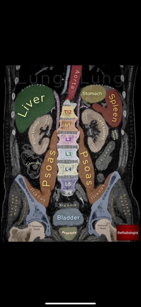 Abdomen Xray, Ct Anatomy, Medical Radiography, Radiologic Technologist, Radiology Student, Scrub Tech, Radiology Technologist, Nurse Study Notes, Medicine Student