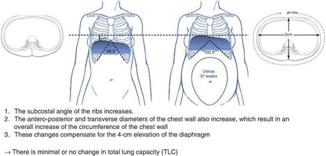 ￼ Physiological changes in respiratory system for a pregnant woman ￼ The normal physiological alterations that occur during pregnancy are very important for fetus survival and labor preparation. During pregnancy, the lung volumes and capacities are changed as there was enlargement of the uterus, and the diaphragm was raised about 4 cm. This leads to upward displacement of the rib cage, expanding the ribs angle with the spine. These progressions expanded the lower thoracic breadth by a Labor Preparation, Prepare For Labor, A Pregnant Woman, Volume And Capacity, Respiratory System, Pregnant Woman, Rib Cage, Respiratory, Pregnant Women