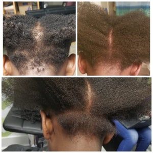 Anti brakeage Hair Growth Whipped Shea Butter Cream Regrow | Etsy Alopecia Hair Growth, Before And After Hair, Regrow Hair, Grow Hair Faster, Hair Tonic, Oil Treatments, Damaged Hair Repair, Growth Oil, Scalp Care