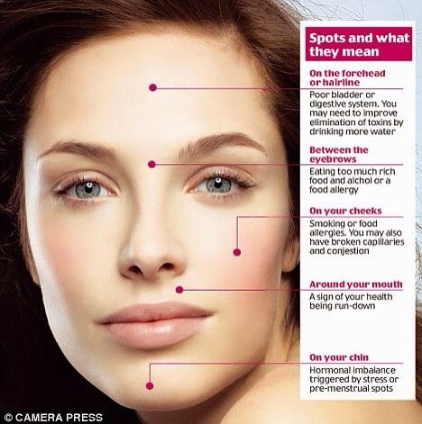 What Your Acne And Pimples Say About You And Your Health.  #Fashion #Beauty #Trusper #Tip Face Mapping Acne, Pimples On Face, Face Mapping, Prevent Pimples, Natural Acne Remedies, Get Rid Of Acne, Rid Of Acne, Acne Causes, Acne Breakout