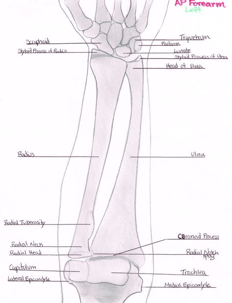 Drawing: Left AP Forearm Forearm Xray Anatomy, Radiology Student, Diagnostic Imaging, Rad Tech, Anatomy And Physiology, Radiology, College Life, X Ray, Biology