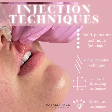 Do you know your injection techniques? Learn everything including the techniques on one of Natalies courses! It is important to know all techniques to give your clients their bespoke lip they are after! #russianlips #aestheticssouthampton #russianliptraininguk #lipfilleruk #liptechnique#liptrainer Lip Filler Technique, Facial Injections, Nurse Injector, Facial Anatomy, Injectables Fillers, Facial Aesthetics, Diy Skincare, Cosmetic Procedures, Lip Fillers