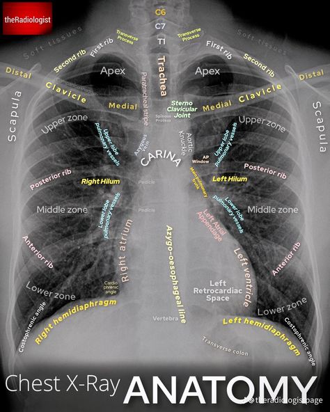 Radiography Student, Medical Radiography, Radiologic Technology, Radiology Student, Radiology Technician, Radiology Imaging, Radiology Tech, Medical Student Study, Medicine Student