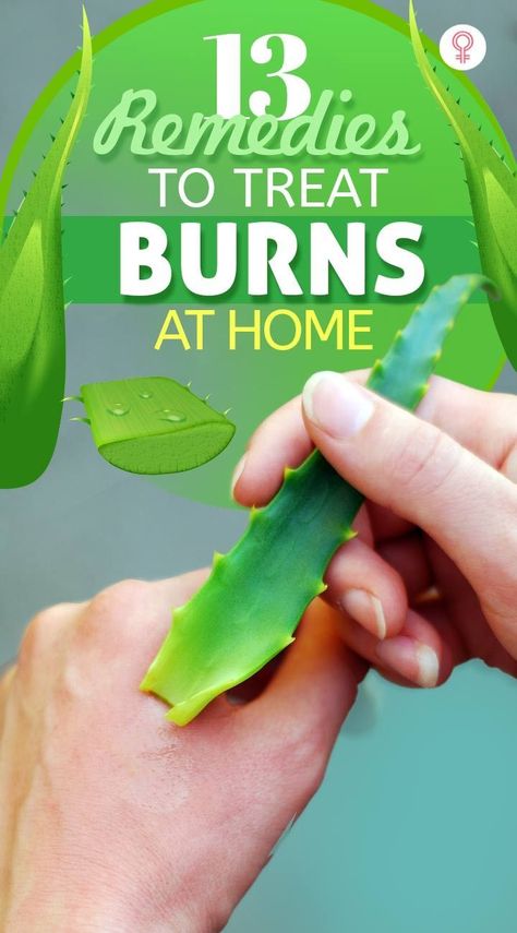 13 Remedies To Treat Burns At Home: They can prevent scarring and further infection. If you do experience burns that go through all layers of your skin, then seek medical attention immediately. In this article, we take a look at the different types of burns and a few home remedies to treat your burns. #remedies #homeremedies #naturalremedies #burns Skin Burn Remedy, What To Put On Burns On Skin, Burn Scar Remedies, Natural Remedies For Burns, Home Remedies For Burns, Types Of Burns, 2nd Degree Burns, Burn Remedy, Scar Remedies