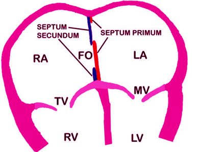 Heart Ultrasound, Cath Lab Nursing, Atrial Septal Defect, Cardiac Sonography, Sonography Student, Nursing Journal, Medical Sonography, Diagnostic Medical Sonography, Work Grind