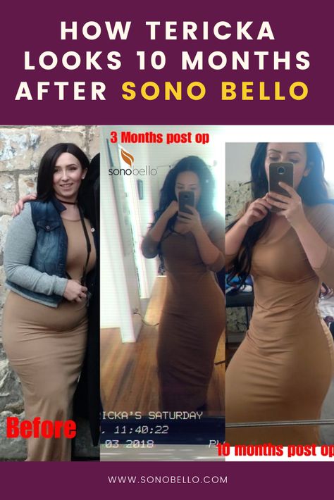 Sonobello Price, Sonobello Before And After Stomach, Sonobello Before And After, Post Op, Summer Ready, New You, Body Image, Inspire Others, Feel Confident