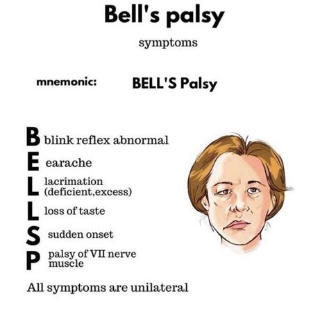 Bell's Palsy #nursingstudent #nursesrock #memorize - Image Credits: Laura Sotorres Pharmacy School Study, Medical Terminology Study, Medical Mnemonics, Nursing School Essential, Nursing School Motivation, Medical School Life, Basic Anatomy And Physiology, Nurse Study Notes, Nursing Mnemonics