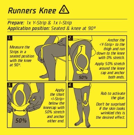 Knee Taping, Patellofemoral Pain Syndrome, K Tape, Runners Knee, Kinesio Tape, Kinesio Taping, Running Injuries, Kinesiology Taping, Knee Exercises