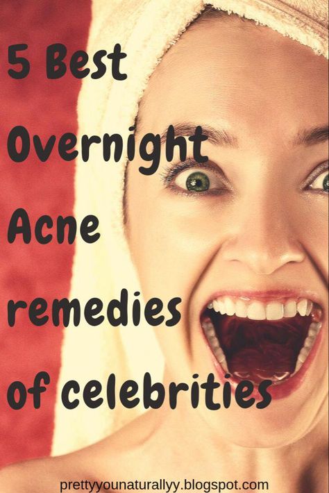 Diy Zit Remover Overnight, Clearing Acne Overnight, Clear Up Skin Fast, How To Get Rid Of Back Acne Overnight, How To Clear Pimples Overnight, How To Clear Your Skin Overnight, How To Clear Skin Overnight, How To Have Clear Skin Overnight, How To Clear Acne Overnight