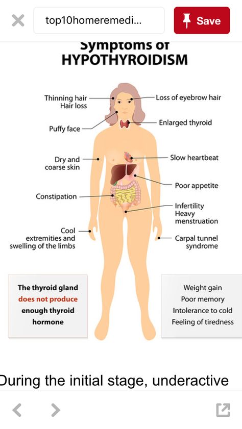 Enlarged Thyroid, Lung Cleanse, Low Thyroid, Thyroid Symptoms, Hashimotos Disease, Thyroid Issues, Thyroid Gland, Thyroid Hormone, Thyroid Health