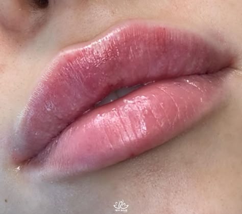 WANTED💋LIPS ™•Chicago•Botox on Instagram: “The Cupid’s Bow is a facial feature where the double curve of a human upper lip is said to resemble the bow of Cupid, the Roman God of…” Bow Lips, Cupids Bow Lips, Cupids Bow, Lip Injections, Upper Lip, Lip Fillers, Fashion Makeup, Eyebrows, Beauty Hacks