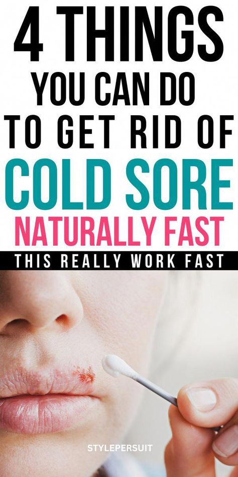 Cold Sore Remedy Fast, Cold Sore Remedy Overnight, Fever Blister Remedy, Cold Remedy Tea, Cold Sore Remedy, Cold Sore Remedies, Blister Remedies, Natural Cold Sore Remedy, Cold Sore Relief