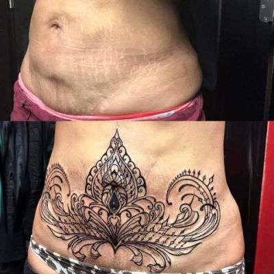 Tuck Tattoos, Stretch Mark Tattoo, Tattoo Healing Process, Tattoo Over Scar, Stomach Tattoos Women, Scar Cover Up, Tattoos To Cover Scars, Belly Tattoos, Mark Tattoo