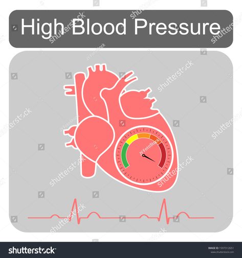 Human cardiac anatomy with speedometer show hypertensive crisis stage and heart beat isolated on grey background.Design for logo.Concept for medical health care.High blood pressure.Vector. #Ad , #SPONSORED, #stage#crisis#heart#isolated Hypertension Poster, Heart Chambers Diagram, Cardiovascular Disease Illustration, Heart Infographic, Logo Design People, Cardiac Anatomy, Pathophysiology Of Hypertension, Medical Health Care, Healthcare Logo