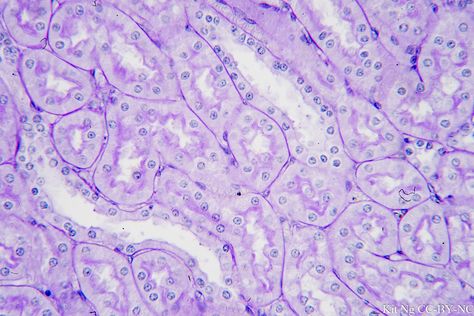 Exocrine Gland, Sweat Gland, Thyroid Gland, The Cell, In The Middle, Square