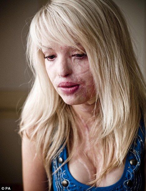 Katie Piper, Skin Care Acne, Inspirational People, Inspirational Women, Character Inspiration, Beautiful People, Persona, A Woman, Louvre