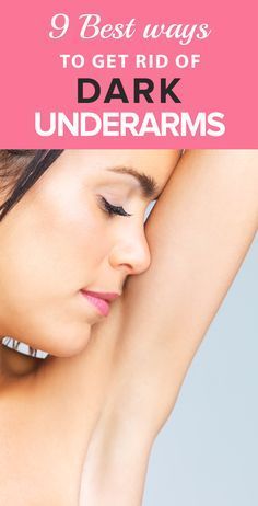 How to Get Rid of Dark Underarms? (Safely) Rid Of Dark Underarms, How To Whiten Underarms, Dark Spots Under Armpits, Dark Armpits, Dark Underarms, Fall Makeup Looks, Remove Dark Spots, Body Hair Removal, Unwanted Hair Removal