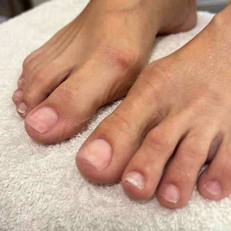 before → poly gel application → final result 🤩 if you have insecurities with your feet / toes you’re not alone 🦶🏼 but let me tell you, this is a judgement freeeeee zone, let’s work together to beautify your feet and boost your confidence 🫡 press the “book now” button in bio ✨ Or send me a dm 🫶🏼 #FootCare #PamperYourFeet #HealthyFeet #SpaDay #FootSpa #modestopedicures #209pedicures #stanislauscounty #downtownmodestosalon #downtownmodesto #modestosalon #modestosalons #modestonailarti... Foot Spa, Healthy Nails, Mani Pedi, Spa Day, Nail Artist, Nail Tech, Manicure And Pedicure, Manicure, Let It Be