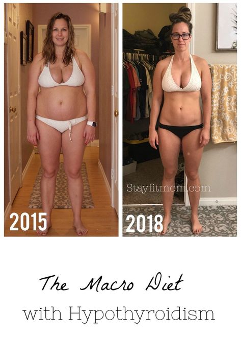 Losing weight on the Macro Diet with hypothyroidism #stayfitmom #hypothyroid #iifym #macrodiet Low Thyroid Remedies, Stay Fit Mom, Macro Diet, Thyroid Remedies, Macros Diet, Low Thyroid, Thyroid Health, Living Tips, Healthy Living Tips