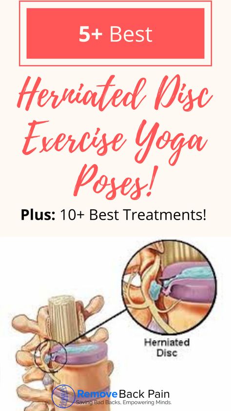 L5 S1 Disc Herniation, Lower Back Pain Stretches, Back Pain Stretches, Bulging Disc, Disk Herniation, Planning A Party, Diy Body Care, Exercise Yoga, Living Your Best Life