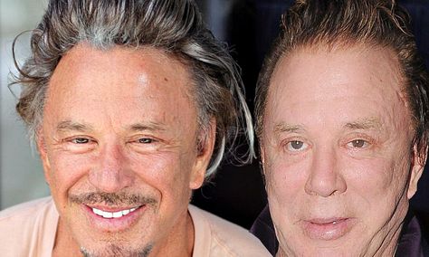 Mickey Rourke's face finally looks great after years of 'bad' surgery Mickey Rourke Plastic Surgery, Facial Reconstruction Surgery, Steve Guttenberg, After Series, Kelly Reilly, Hedy Lamarr, Golden Globe Winners, Mickey Rourke, Kim Basinger