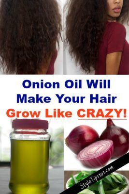 Recipe For Hair Growth, Onion Hair Growth, Hair Oil For Hair Growth, Onion Hair Oil, Hair Growth Cream, Onion Juice For Hair, Rosemary Oil For Hair Growth, Onion Hair, Onion Oil