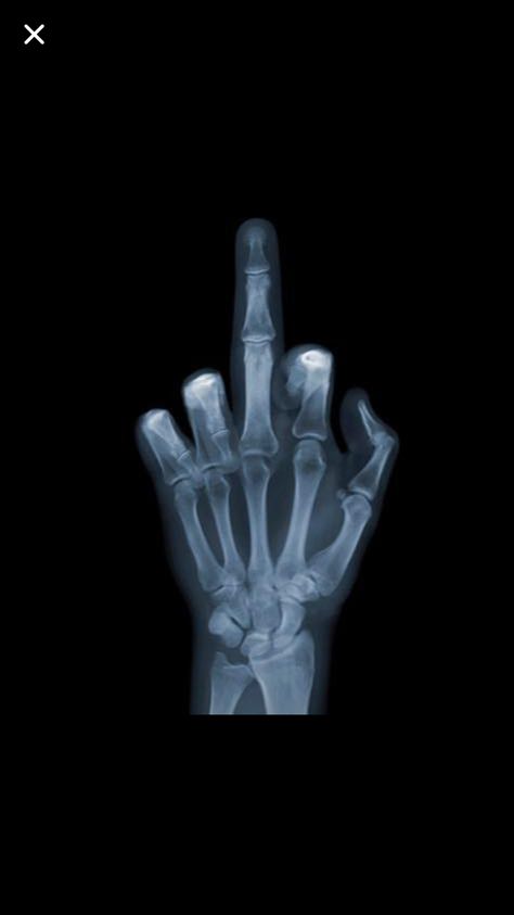 Middle finger xray Xray Art, Xray Tech, Retro Pop, Pc Cases, Radiology, X Ray, Apple Iphone, Bones, Phone Wallpaper