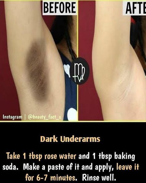 Lighten Intimate Areas, Diy Scrubs, Freetime Activities, Clear Healthy Skin, Natural Skin Care Remedies, Diy Skin Care Routine, Natural Face Skin Care, Dark Underarms, Good Skin Tips