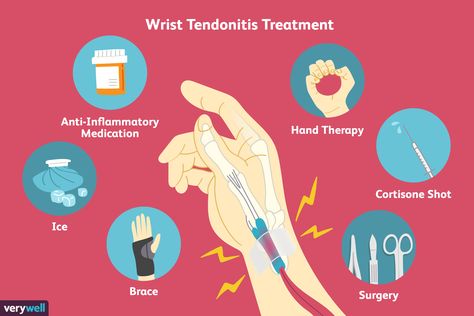 Wrist tendonitis is a common problem that can cause pain and swelling around the wrist. What you do early on can prevent further problems. Wrist Pain Relief, Pregnancy Images, Foot Reflexology Massage, Pain Relief Remedies, Wrist Pain, Reflexology Massage, Nerve Pain Relief, Foot Reflexology, Knee Pain Relief