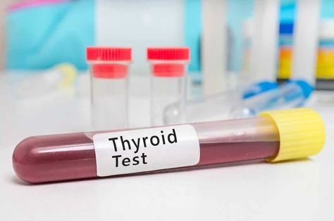 If you have been getting thyroid tests done, understand why they lack accuracy and what you can do to naturally improve thyroid health. T3 Hormone, Thyroid Awareness Month, Thyroid Imbalance, Cholesterol Test, Thyroid Test, Thyroid Symptoms, Thyroid Medication, Lipid Profile, Thyroid Function