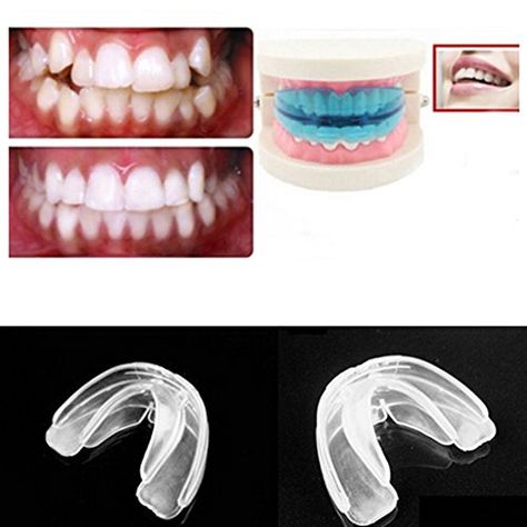 Braces are not the only option people have when it comes to straightening their teeth. Find out how you can do it at your convenience and for a lesser cost. Straighten Teeth Without Braces, Crooked Teeth, Laser Teeth Whitening, Front Teeth, Orthodontics Braces, Teeth Straightening, Straight Teeth, Teeth Braces, Best Teeth Whitening