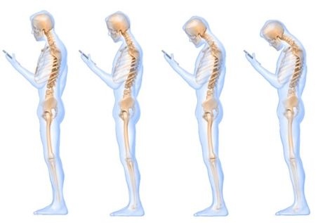 A new study suggests that looking down at a cell phone is the equivalent of placing a 60-pound weight on one's neck. Healthier Me, Text Neck, Healthy Spine, Tight Hip Flexors, Psoas Muscle, Chronic Migraines, Bad Posture, A Cell, Hip Flexor